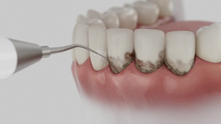 Reliable Dental Implants contractor in Lansing, MI by Smile Center Dentistry